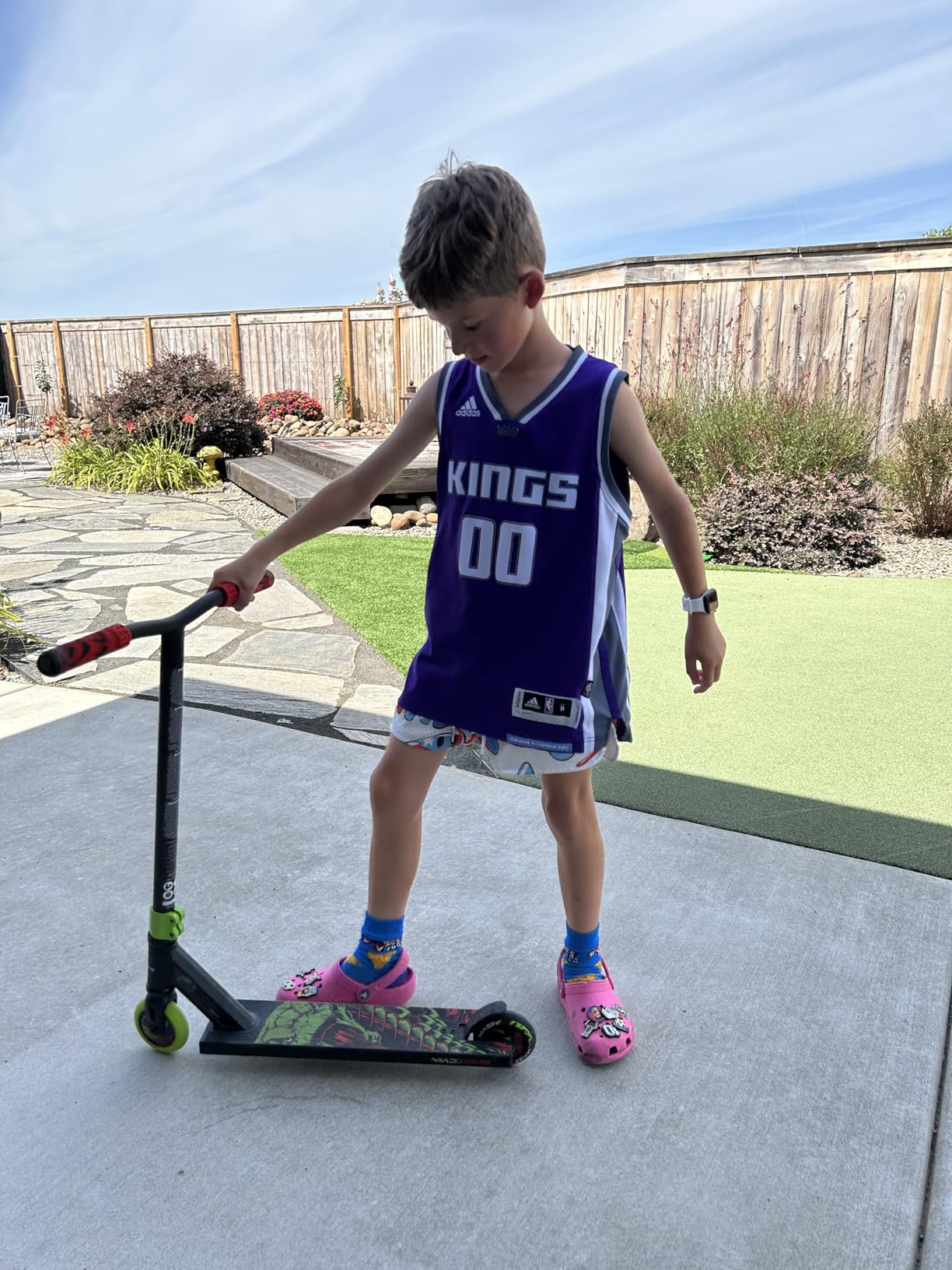Madd Gear Pro Stunt Trick Scooter for Kids Ages 5-12 - Lightweight Durable Freestyle Kick Scooter for Skatepark and Street - Easy Assembly - MG2 customer photo 1
