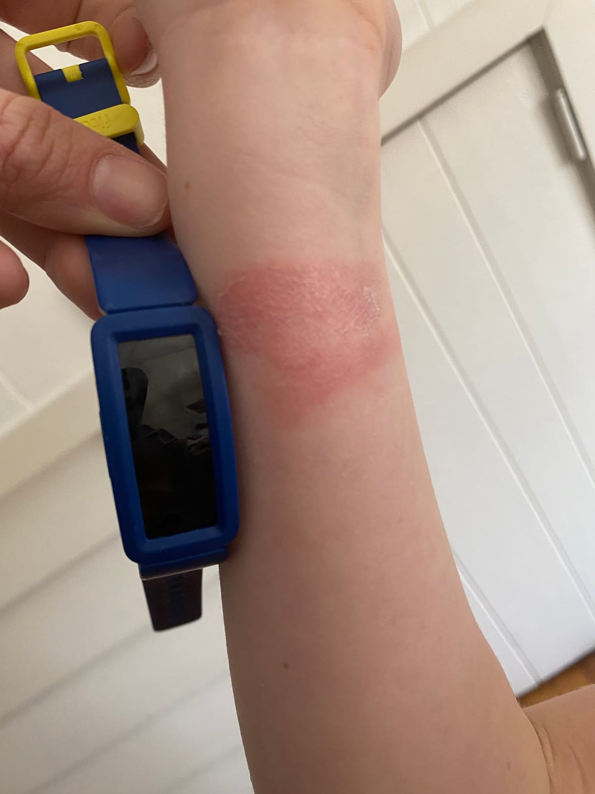 Fitbit Ace 2 Activity Tracker for Kids, Night Sky + Neon Yellow customer photo 1