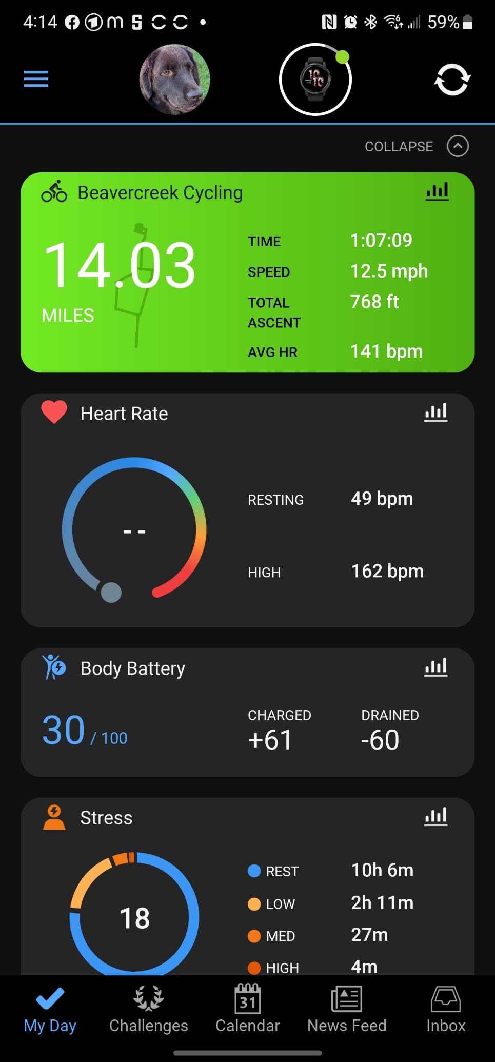 Garmin Venu 2, GPS Smartwatch with Advanced Health Monitoring and Fitness Features, Slate Bezel with Black Case and Silicone Band customer photo 2