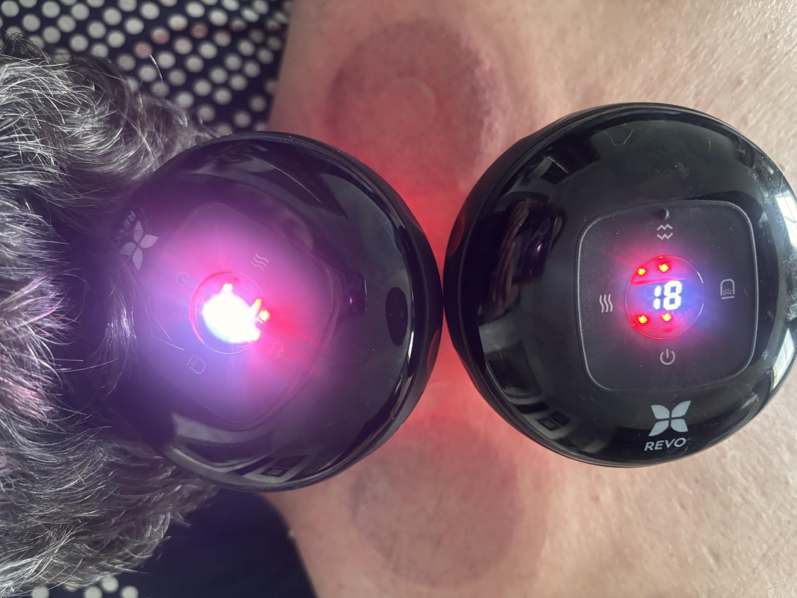 REVO The Original 4-in-1 Smart Cupping Massager with LED Light, Heat, Dynamic Suction & Vibration Massage, Portable Cordless Rechargeable Cupping Device for Body- 1 Pack customer photo 1
