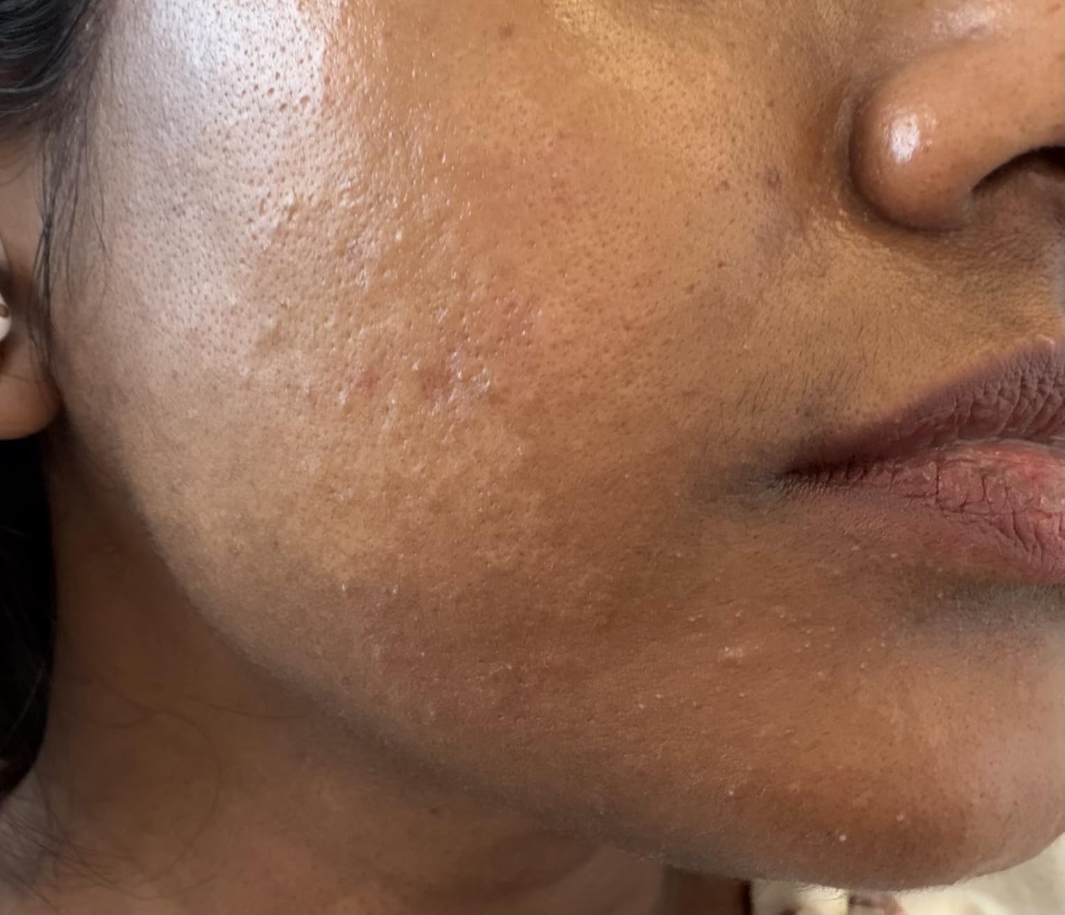 La Roche-Posay Cicaplast Balm B5 customer photo 2
