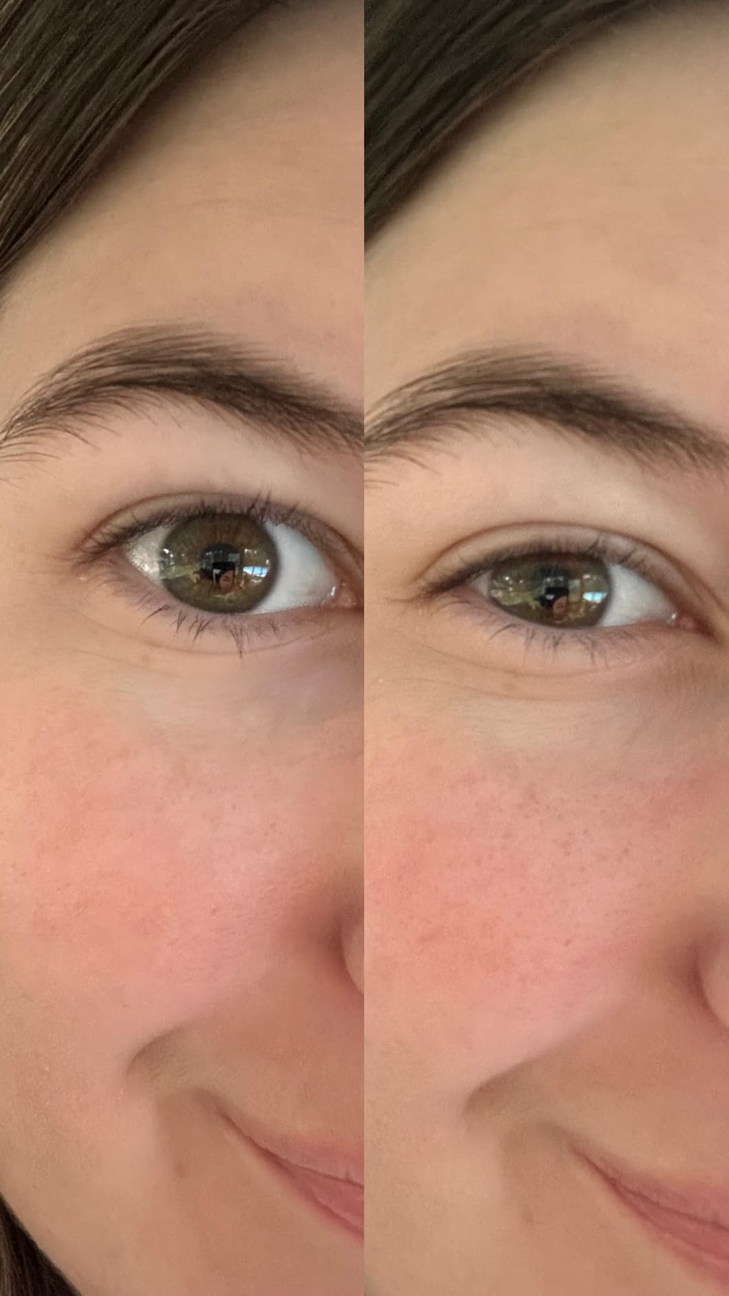 PEAUAMIE Under Eye Patches customer photo 1