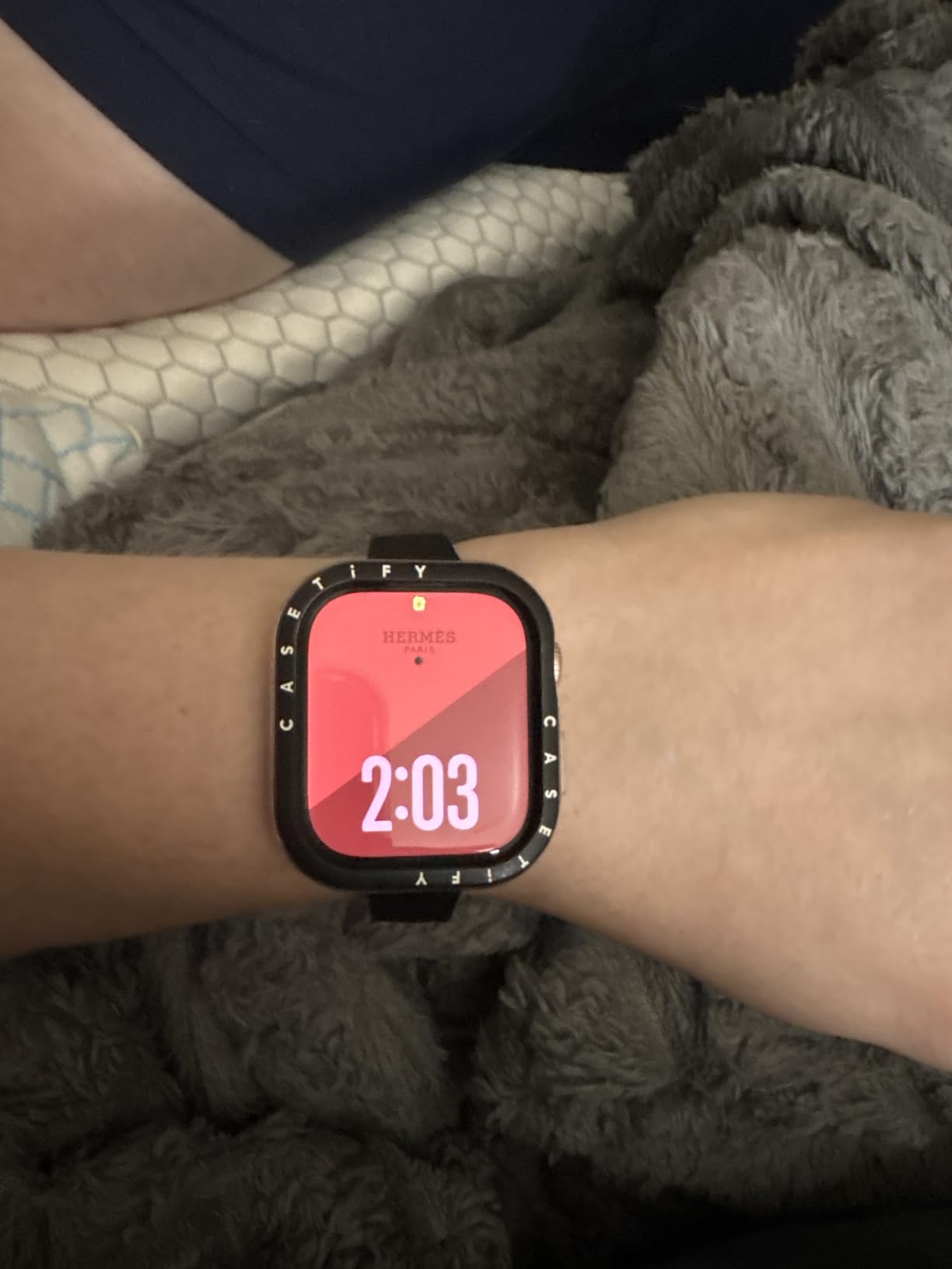 Apple Watch Series 10 customer photo 2